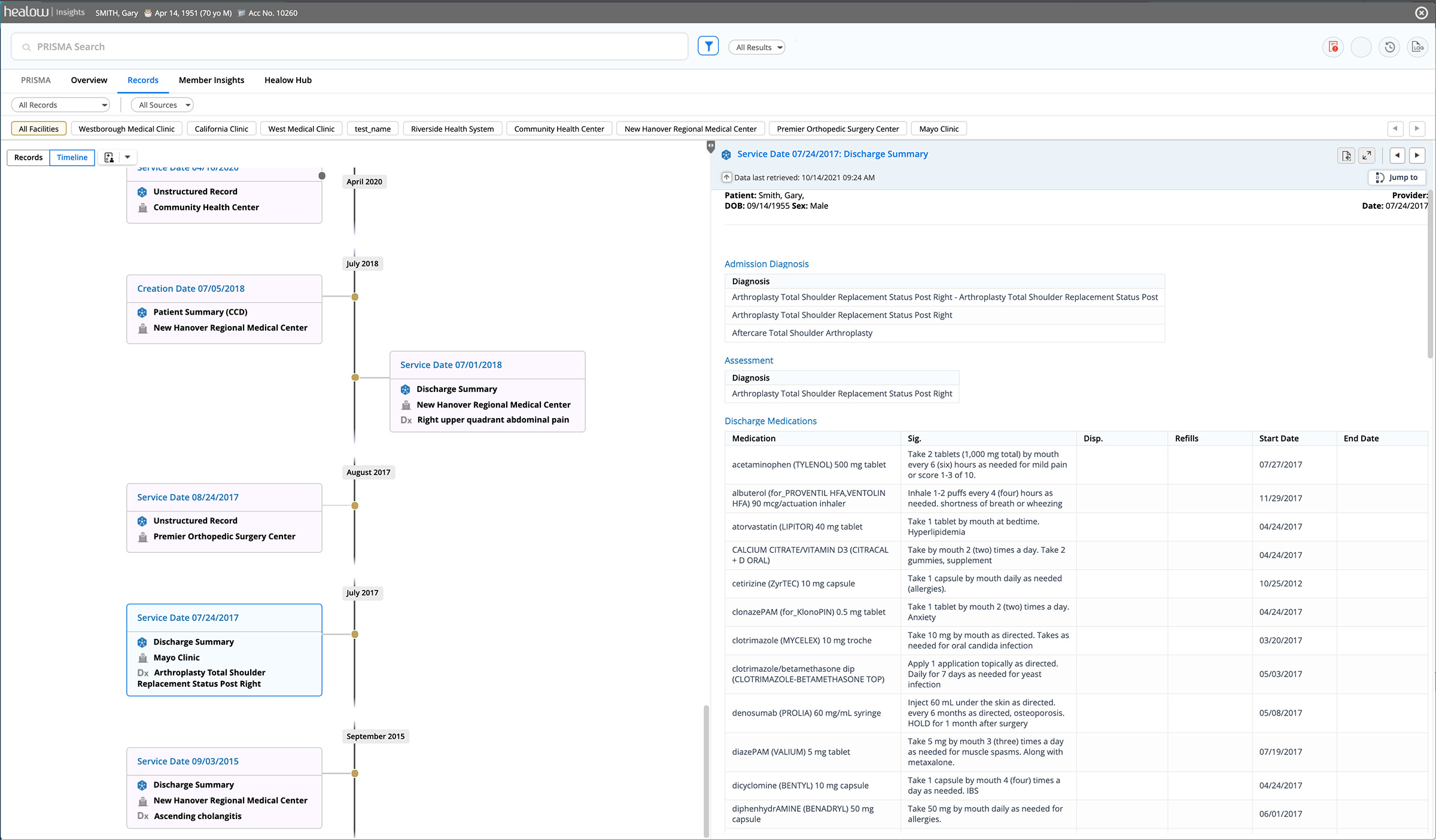 Screenshot of the timeline view of PRISMA product